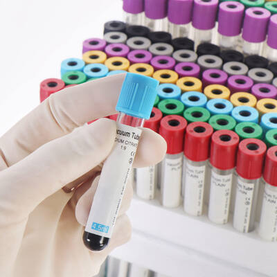 खरीदें पूर्ण रक्त गणना (सीबीसी) के लिए वैक्यूम ईडीटीए रक्त नलिकाएँ ऑनलाइन निर्माण